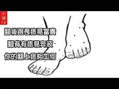 腳側邊有痣|非富即貴！5種腳相註定好命 痣長在這裡「天生帝王命」 